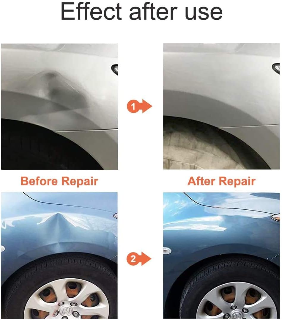 Dent Repair Kit for Cars J8629